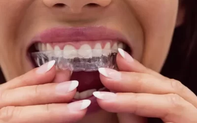 Invisalign St Louisville: Clear Aligner Therapy for Discreet Orthodontic Correction